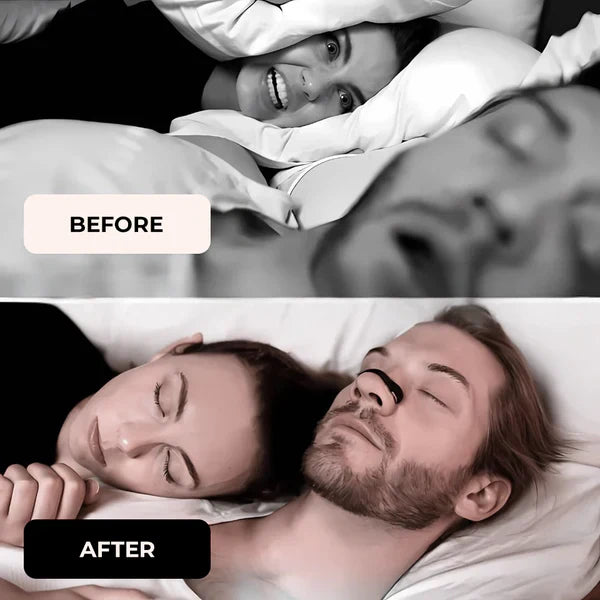 FurBlu Air One The Next-Generation Magnetic Nasal Strip